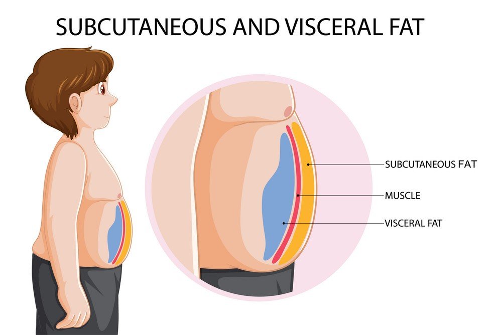 visceral and subcutaneous fat, Do Ab Workouts Burn Belly Fat?