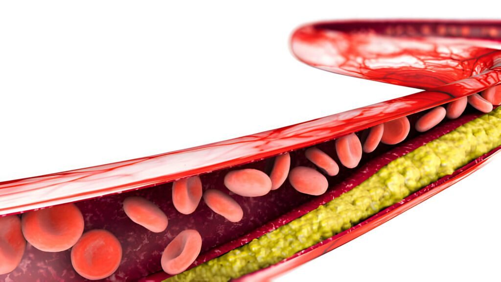 triglycerides in the blood